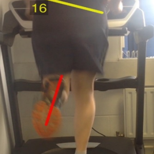 Full Gait Analysis